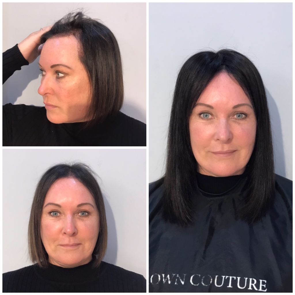 Hair Integration System Edinburgh | Wigs Edinburgh